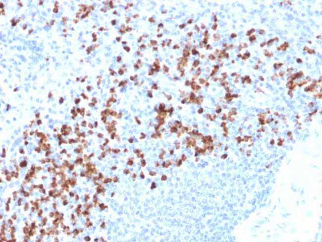 MMP9 (Matrix Metalloproteinase 9) Antibody in Immunohistochemistry (Paraffin) (IHC (P))