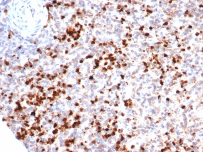 Myeloperoxidase/MPO Antibody in Immunohistochemistry (Paraffin) (IHC (P))
