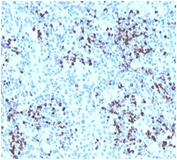 Myeloperoxidase/MPO Antibody in Immunohistochemistry (Paraffin) (IHC (P))