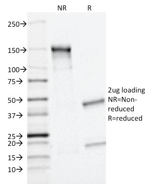 MRP1/ABCC1 (Multidrug Resistance Related Protein 1) Antibody in SDS-PAGE (SDS-PAGE)