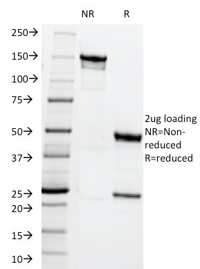 MRP1/ABCC1 (Multidrug Resistance Related Protein 1) Antibody in SDS-PAGE (SDS-PAGE)