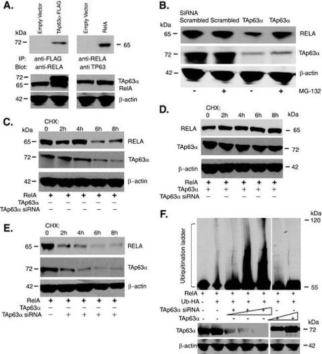 NFkB p65 Antibody in Western Blot (WB)