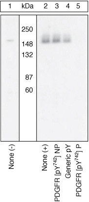 Phospho-PDGFRA (Tyr742) Antibody in Western Blot (WB)