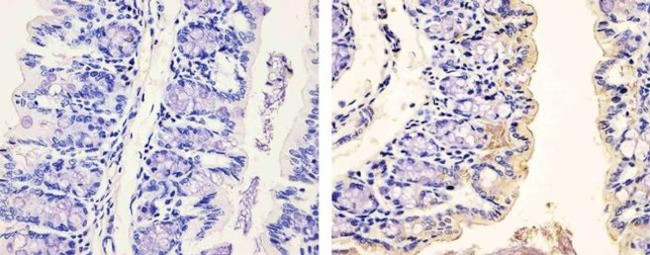 Phospho-PDGFRA (Tyr754) Antibody in Immunohistochemistry (Paraffin) (IHC (P))