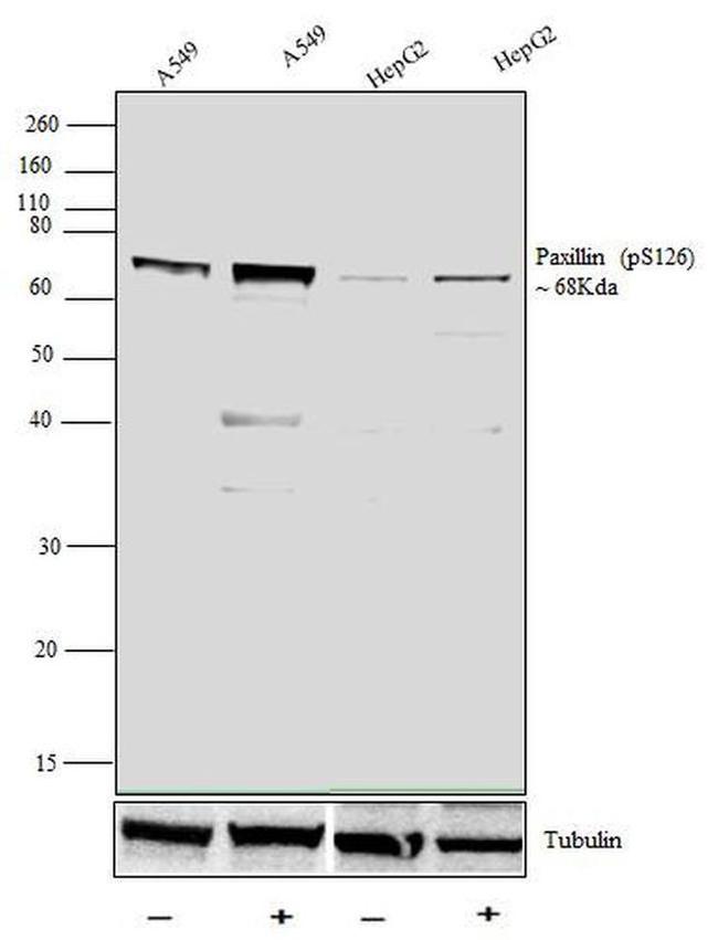 Phospho-Paxillin (Ser126) Antibody in Western Blot (WB)