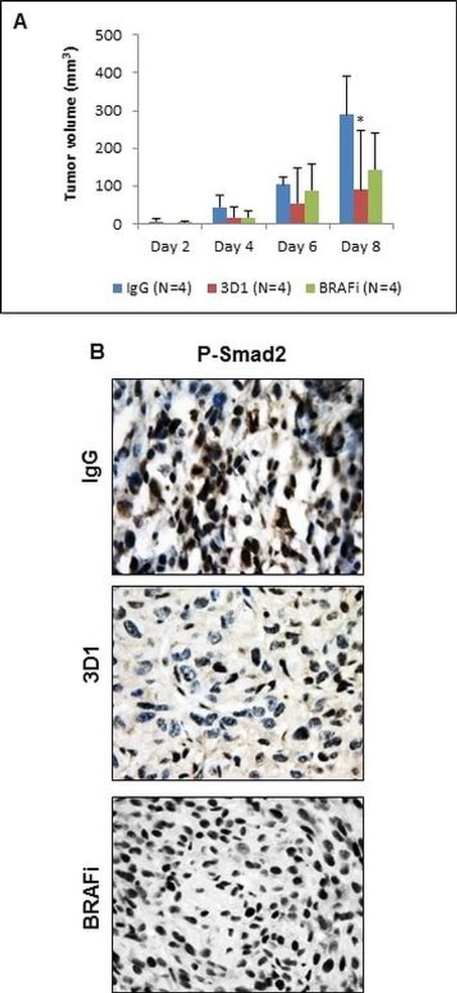 Phospho-SMAD2 (Ser465, Ser467) Antibody in Immunohistochemistry (IHC)