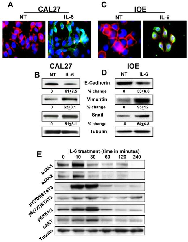 Phospho-JAK2 (Tyr1007, Tyr1008) Antibody in Western Blot (WB)