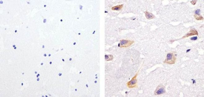 Phospho-SHP2 (Tyr542) Antibody in Immunohistochemistry (Paraffin) (IHC (P))