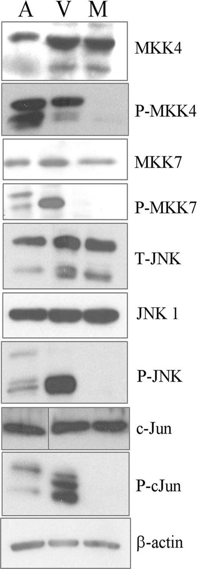 Phospho-JNK1/JNK2 (Thr183, Tyr185) Antibody in Western Blot (WB)