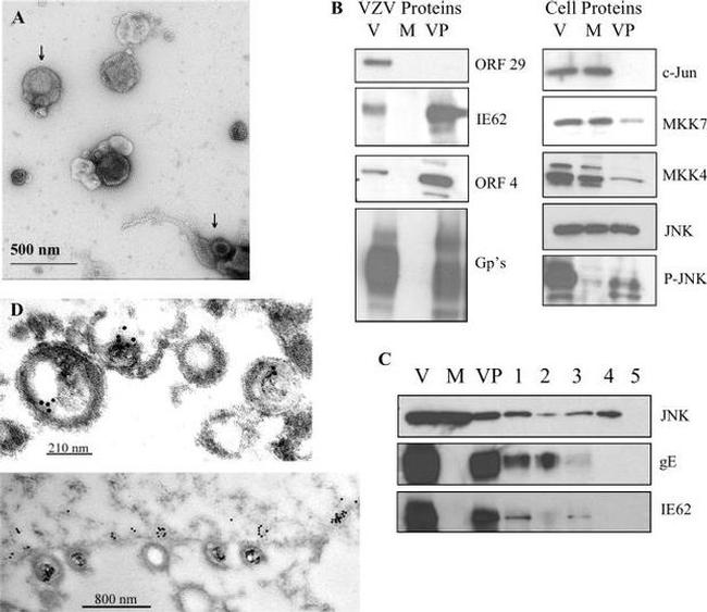 Phospho-JNK1/JNK2 (Thr183, Tyr185) Antibody in Western Blot (WB)