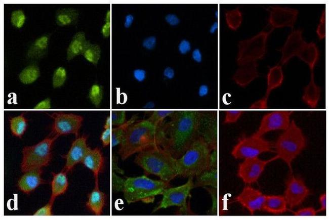 Phospho-JNK1/JNK2 (Thr183, Tyr185) Antibody