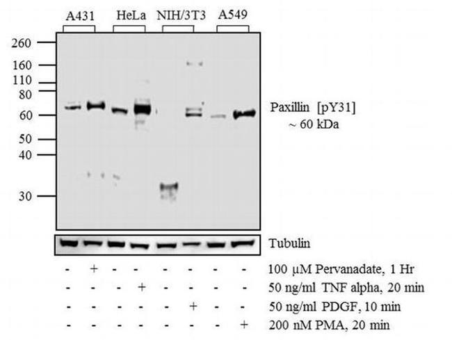 Phospho-Paxillin (Tyr31) Antibody in Western Blot (WB)