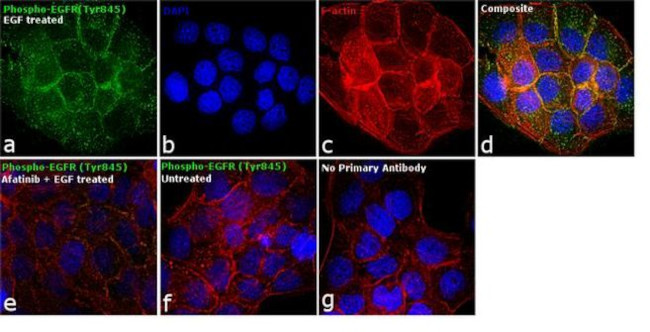 Phospho-EGFR (Tyr845) Antibody in Immunocytochemistry (ICC/IF)