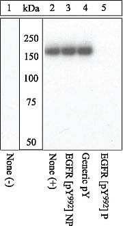 Phospho-EGFR (Tyr992) Antibody in Western Blot (WB)