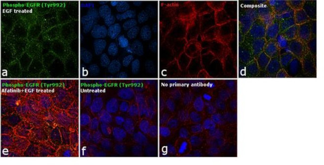 Phospho-EGFR (Tyr992) Antibody in Immunocytochemistry (ICC/IF)