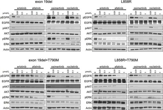 Phospho-EGFR (Tyr1068) Antibody in Western Blot (WB)