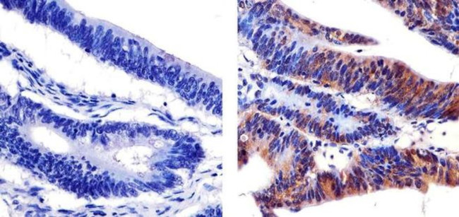 Phospho-SHC (Tyr239, Tyr240) Antibody in Immunohistochemistry (Paraffin) (IHC (P))