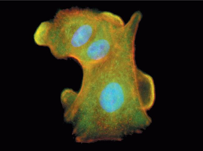 Phospho-PAK1/2/3 (Thr423) Antibody in Immunocytochemistry (ICC/IF)