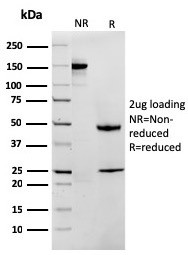 MTAP (Tumor Suppressor Marker) Antibody in SDS-PAGE (SDS-PAGE)