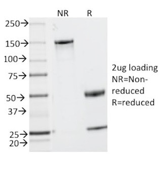 MUC2 (Mucin 2) Antibody in SDS-PAGE (SDS-PAGE)
