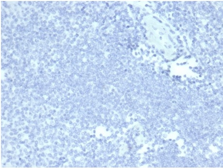 MUC5AC (Mucin 5AC/Gastric Mucin) Antibody in Immunohistochemistry (Paraffin) (IHC (P))