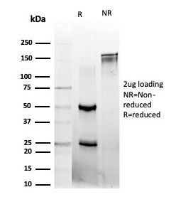 L-Myc/MYCL1 (Transcription Factor) Antibody in SDS-PAGE (SDS-PAGE)