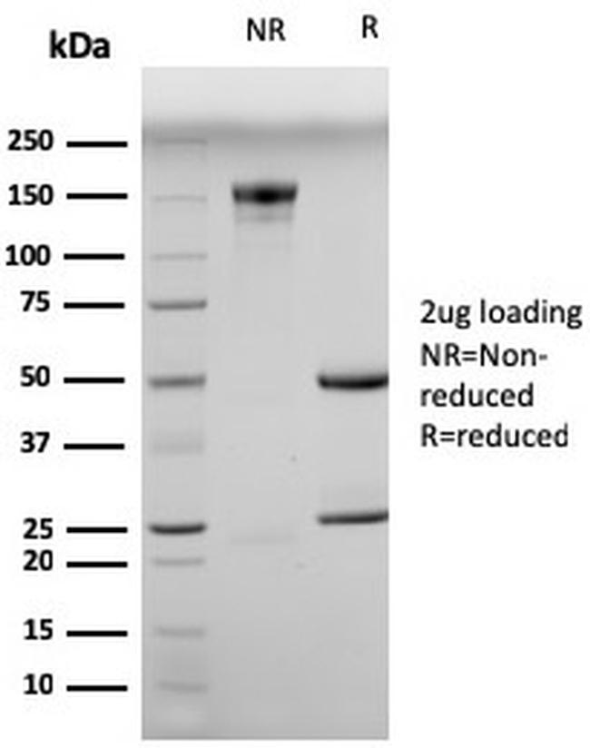 Myogenin/Myf-4 Antibody in SDS-PAGE (SDS-PAGE)