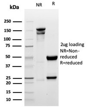 Myogenin/Myf-4 (Skeletal Muscle Marker) Antibody in SDS-PAGE (SDS-PAGE)