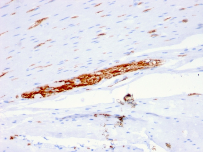 CD56/NCAM1/NKH1 (Neuronal Cell Marker) Antibody in Immunohistochemistry (Paraffin) (IHC (P))