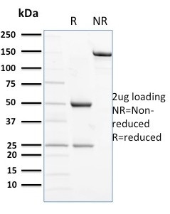 CD56/NCAM1/NKH1 (Neuronal Cell Marker) Antibody in SDS-PAGE (SDS-PAGE)