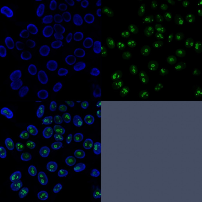 Nucleolin (Marker of Human Cells) Antibody in Immunocytochemistry (ICC/IF)