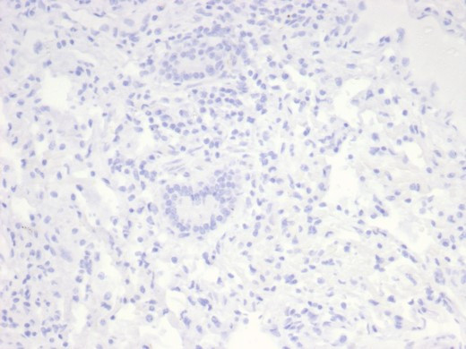 Nucleolin (Marker of Human Cells) Antibody in Immunohistochemistry (Paraffin) (IHC (P))