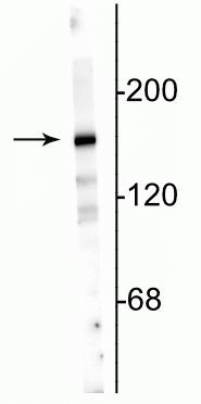 NMDAR2A Antibody in Western Blot (WB)