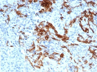 NGF-Receptor (p75)/CD271 (Soft Tissue Tumor Marker) Antibody in Immunohistochemistry (Paraffin) (IHC (P))