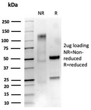 NGF-Receptor (p75)/CD271 (Soft Tissue Tumor Marker) Antibody in SDS-PAGE (SDS-PAGE)