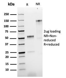 NGF-Receptor (p75)/CD271 Antibody in SDS-PAGE (SDS-PAGE)