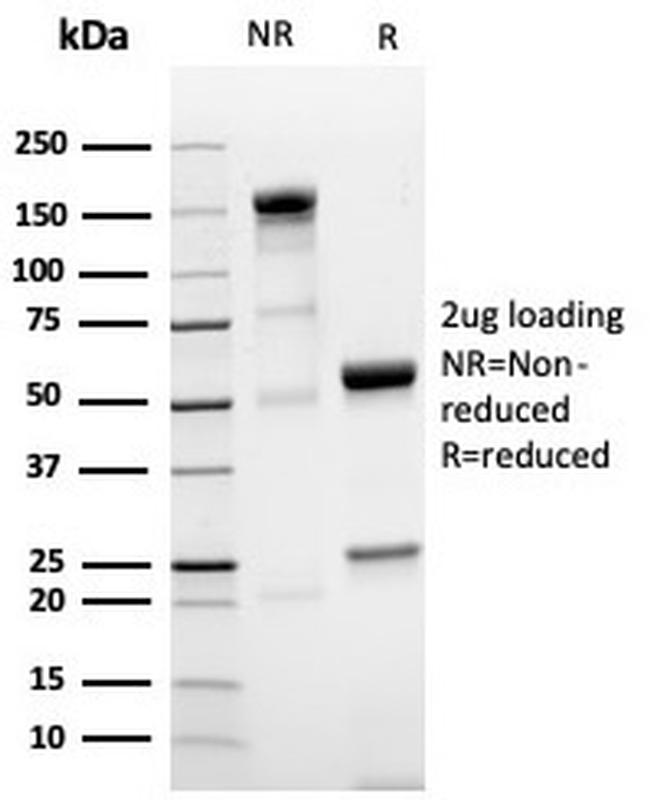 NKX3.1 Antibody in SDS-PAGE (SDS-PAGE)