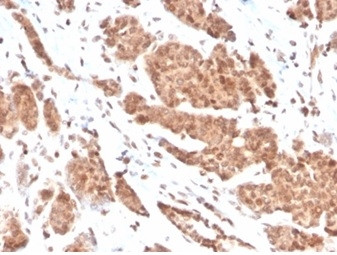 Nucleoside Diphosphate Kinase A/nm23-H1 Antibody in Immunohistochemistry (Paraffin) (IHC (P))