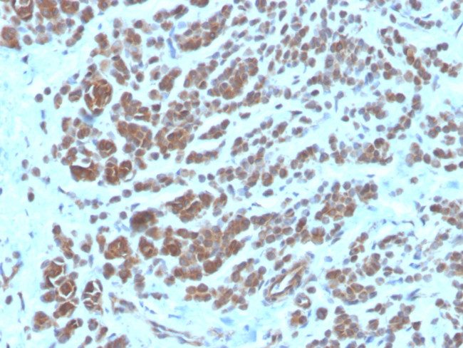 NME2/nm23-H2/NDPK-B (Suppressor of Metastasis) Antibody in Immunohistochemistry (Paraffin) (IHC (P))