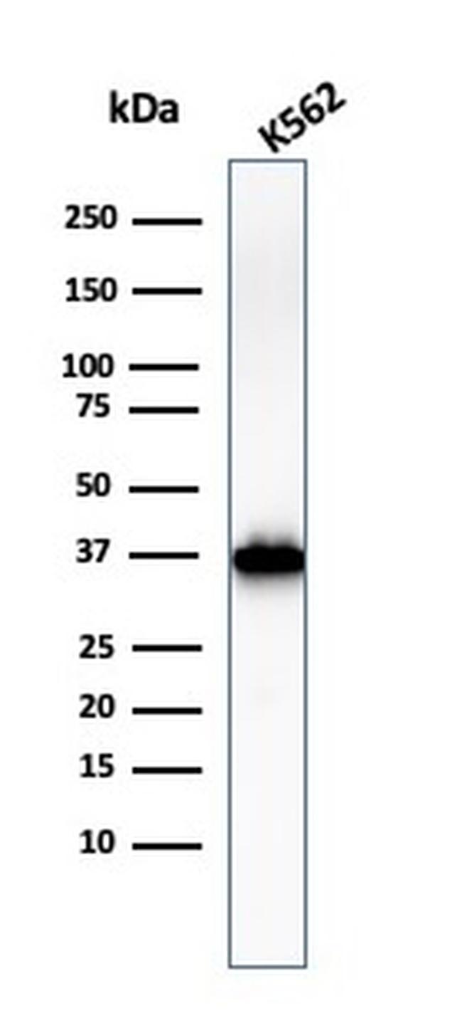 Nucleophosmin Antibody in Western Blot (WB)