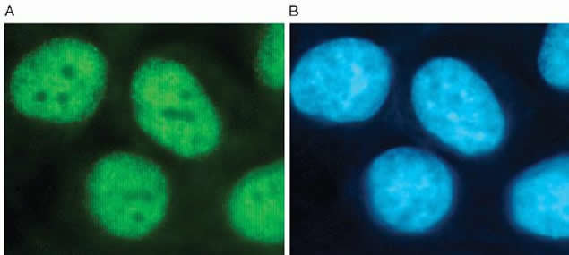 H3K4me3 Antibody in Immunocytochemistry (ICC/IF)