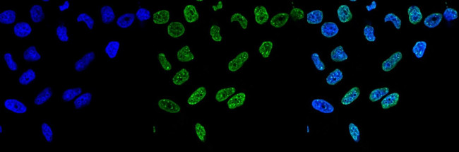 H3K9me3 Antibody in Immunocytochemistry (ICC/IF)