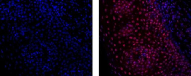 Pokemon (LRF) Antibody in Immunohistochemistry (Paraffin) (IHC (P))