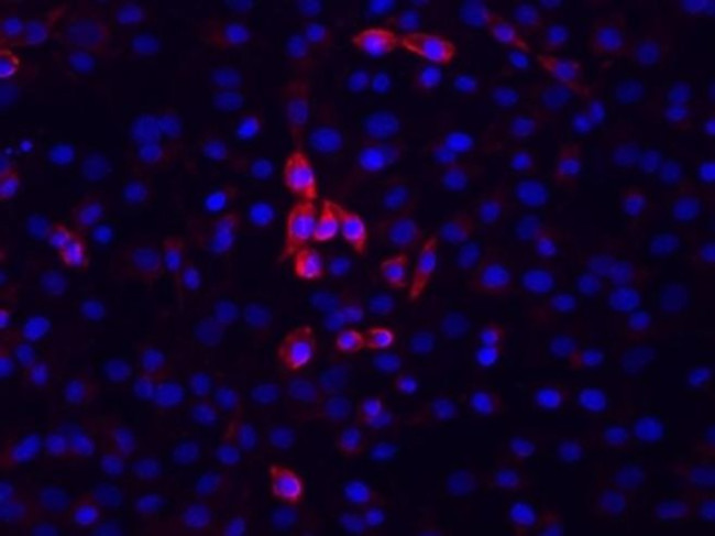 IgM Antibody in Immunocytochemistry (ICC/IF)