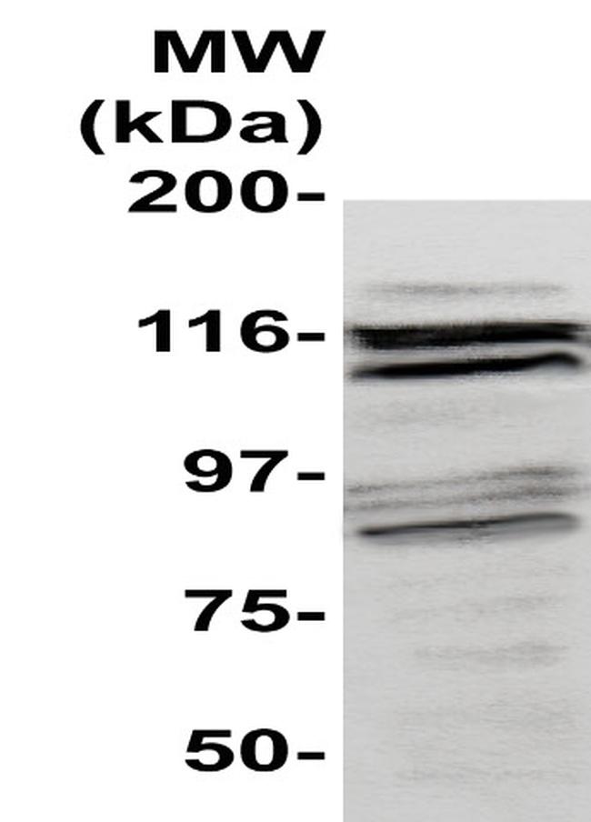 CD54 Antibody in Western Blot (WB)