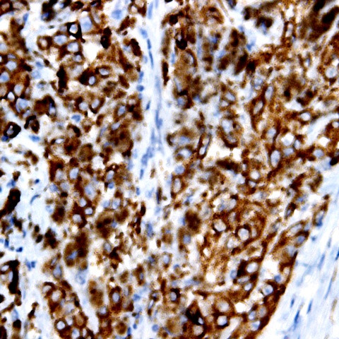 CD11b Antibody in Immunohistochemistry (Paraffin) (IHC (P))