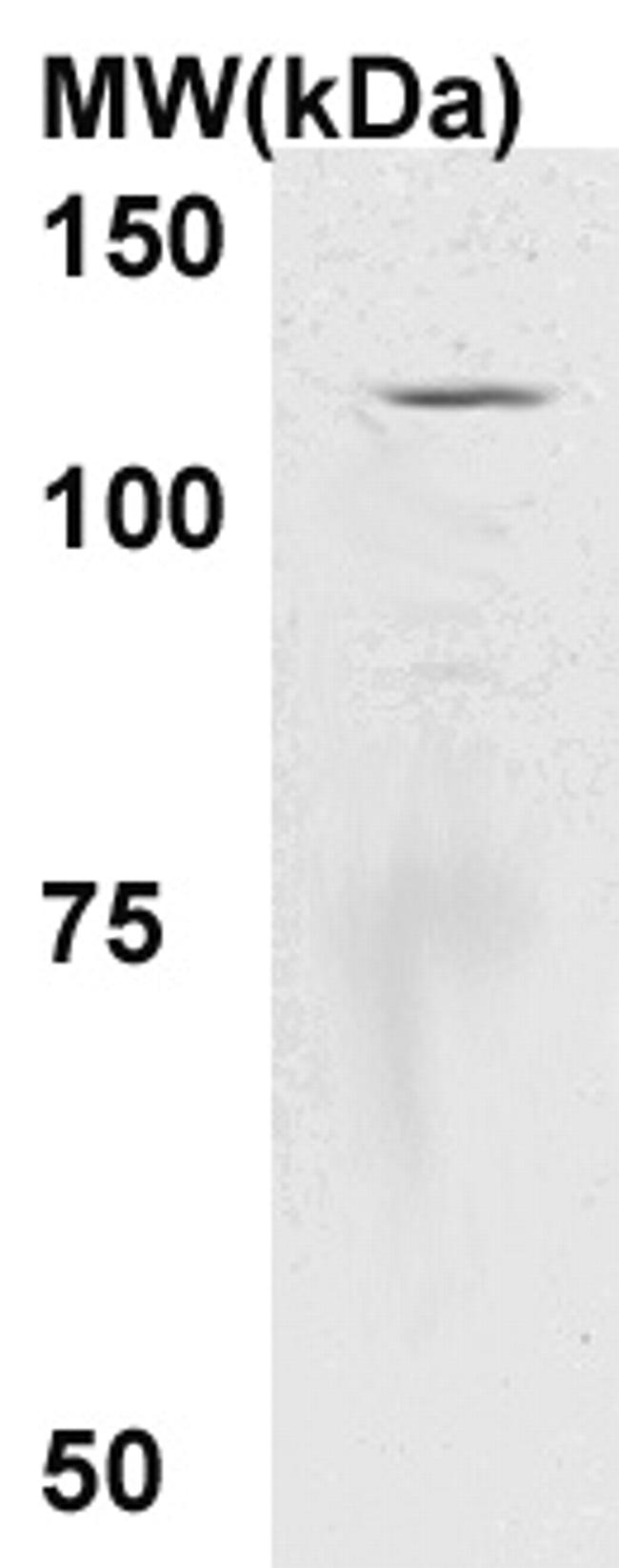 CD11b Antibody in Western Blot (WB)