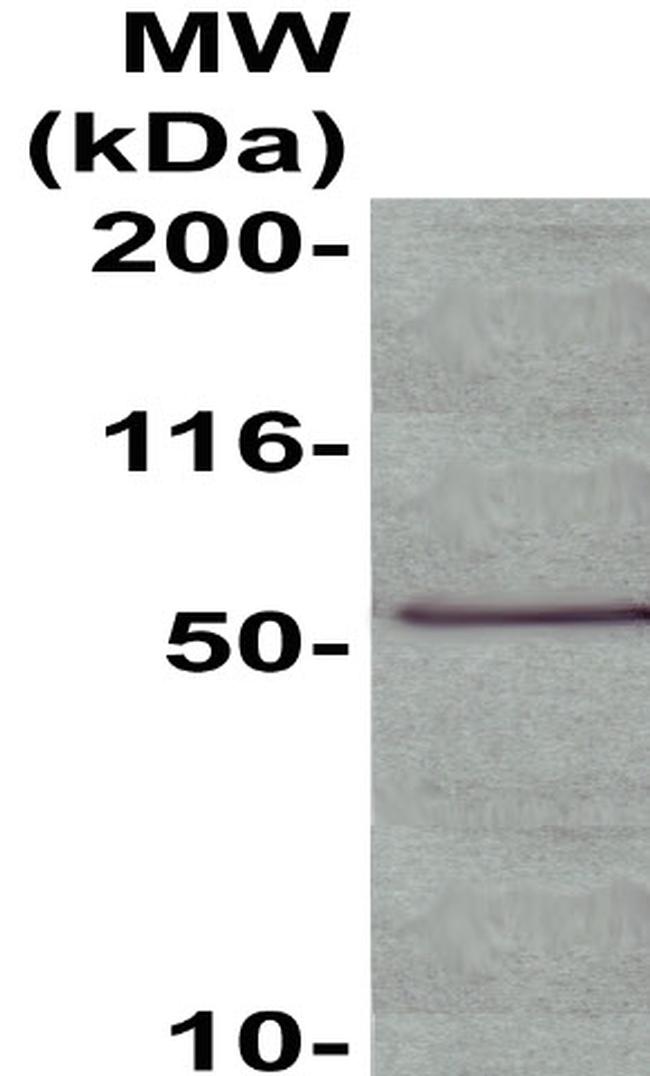 Phospho-NF-kB P65 (Ser536) Polyclonal Antibody (500-11924)