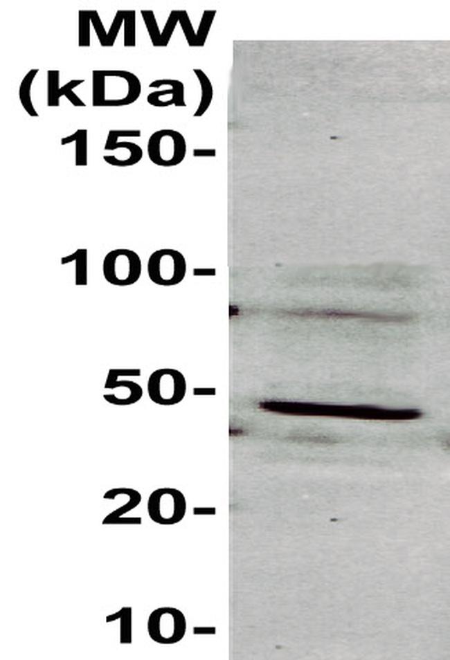 Cytokeratin 20 Antibody in Western Blot (WB)