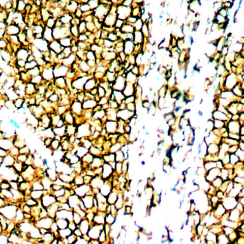 CD20 Antibody in Immunohistochemistry (Paraffin) (IHC (P))